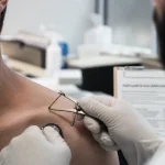 Ganglion de Troisier : boule sus-claviculaire gauche, bilan digestif