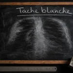 Tache blanche aux poumons sur radio thorax