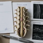 IRM pour cancer moelle épinière : repères face à la douleur dorsale