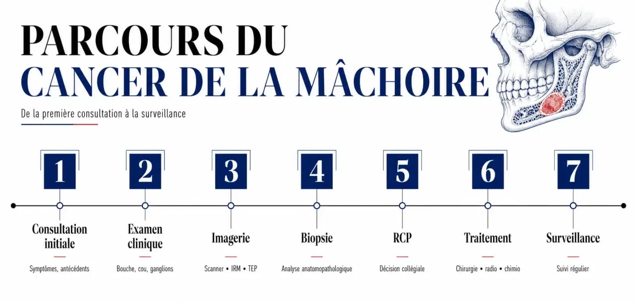 Parcours de diagnostic du cancer de la mâchoire de la consultation au traitement