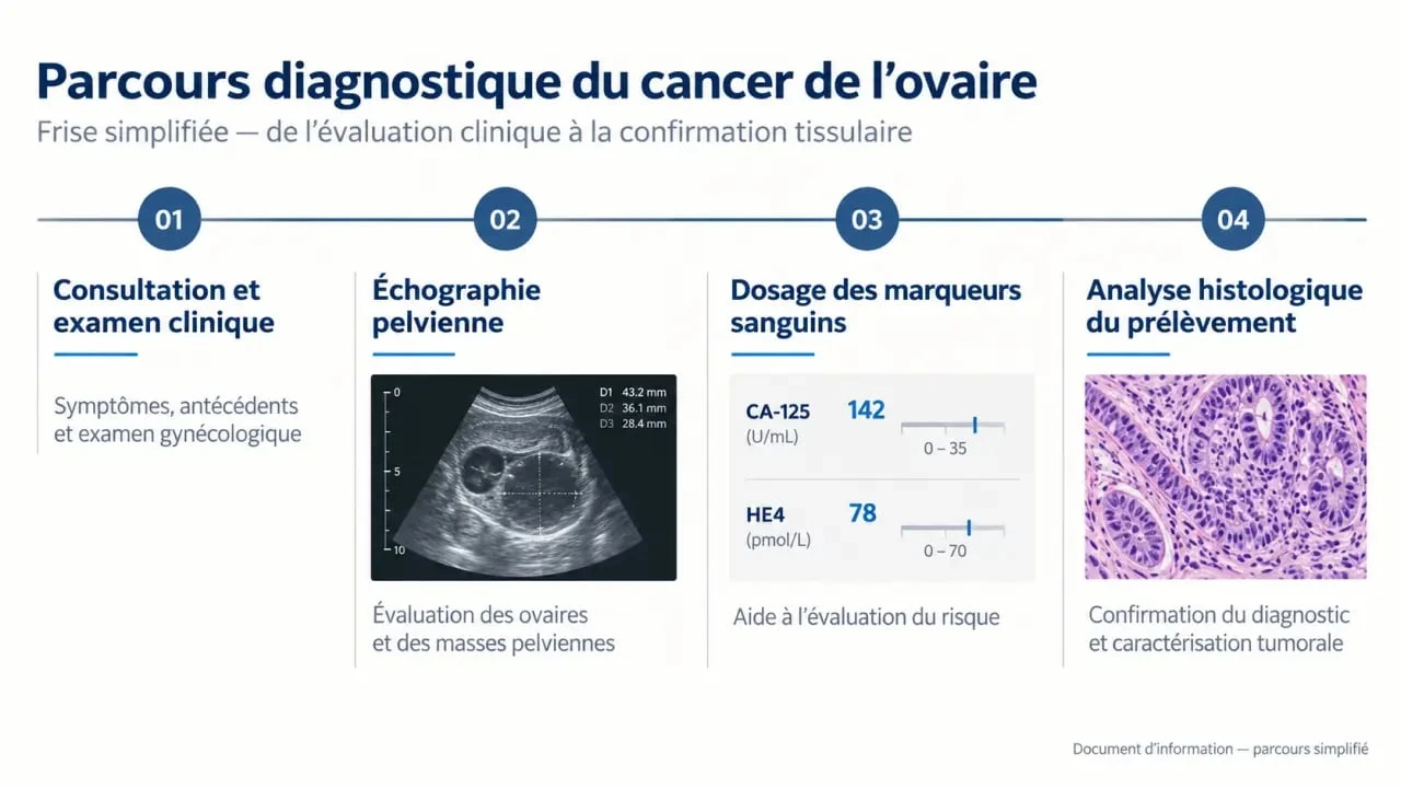 Parcours diagnostic du cancer de l'ovaire de la consultation à l'analyse histologique