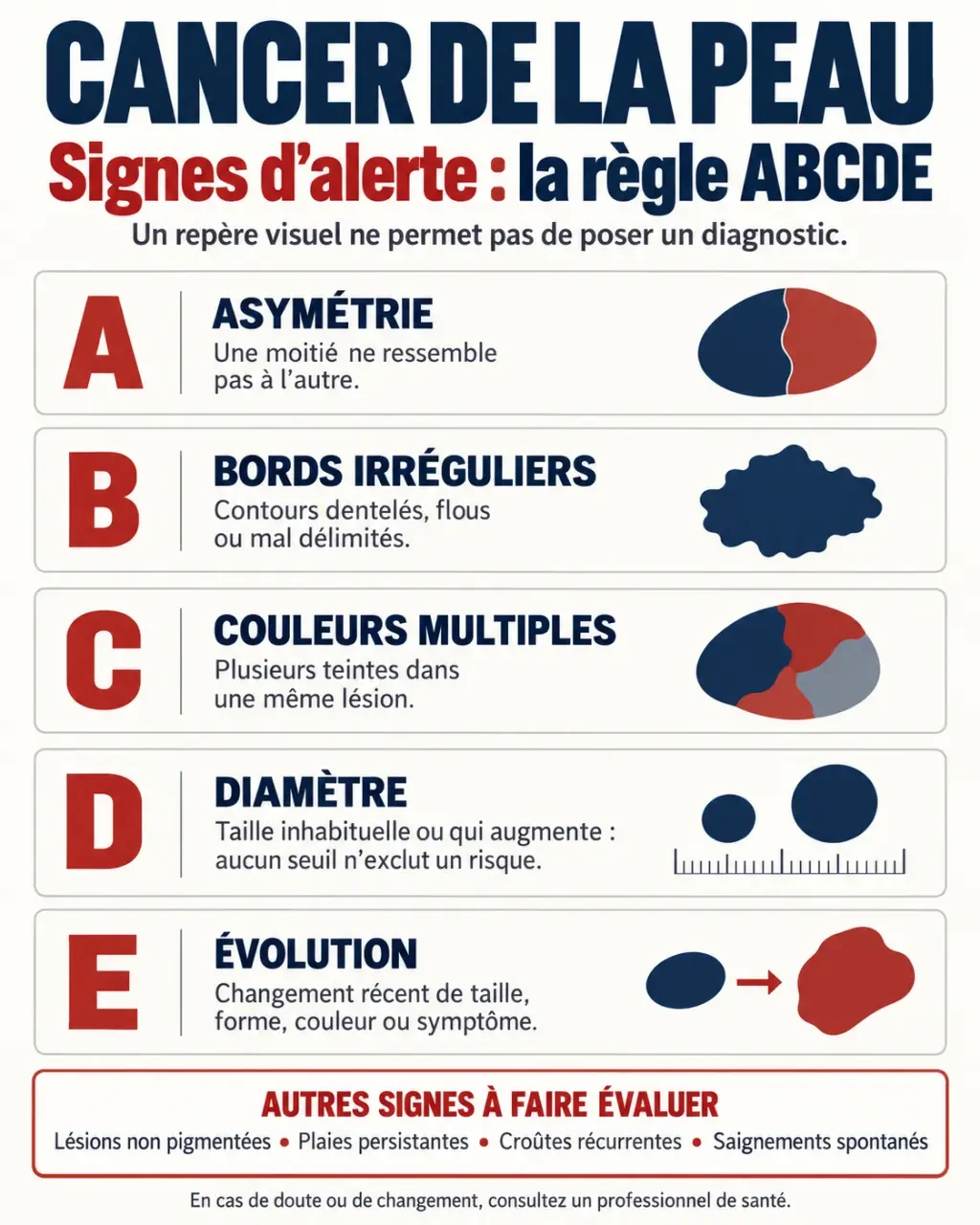 Infographie sur les signes du cancer d la peau et la règle ABCDE
